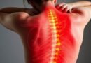 Back Pain: Causes, Management, and Prevention