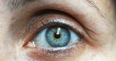 strained eyes